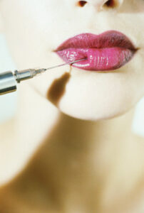 Young woman having collagen injection in lips --- Image by © Crisco/Corbis